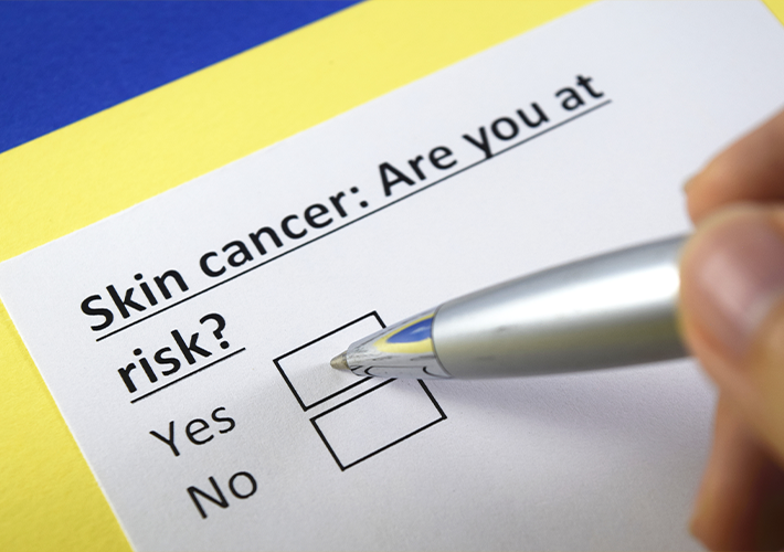 Skin-Cancer_Are-You-At-Risk_BLOGSIZED Skin Cancer Are You At Risk